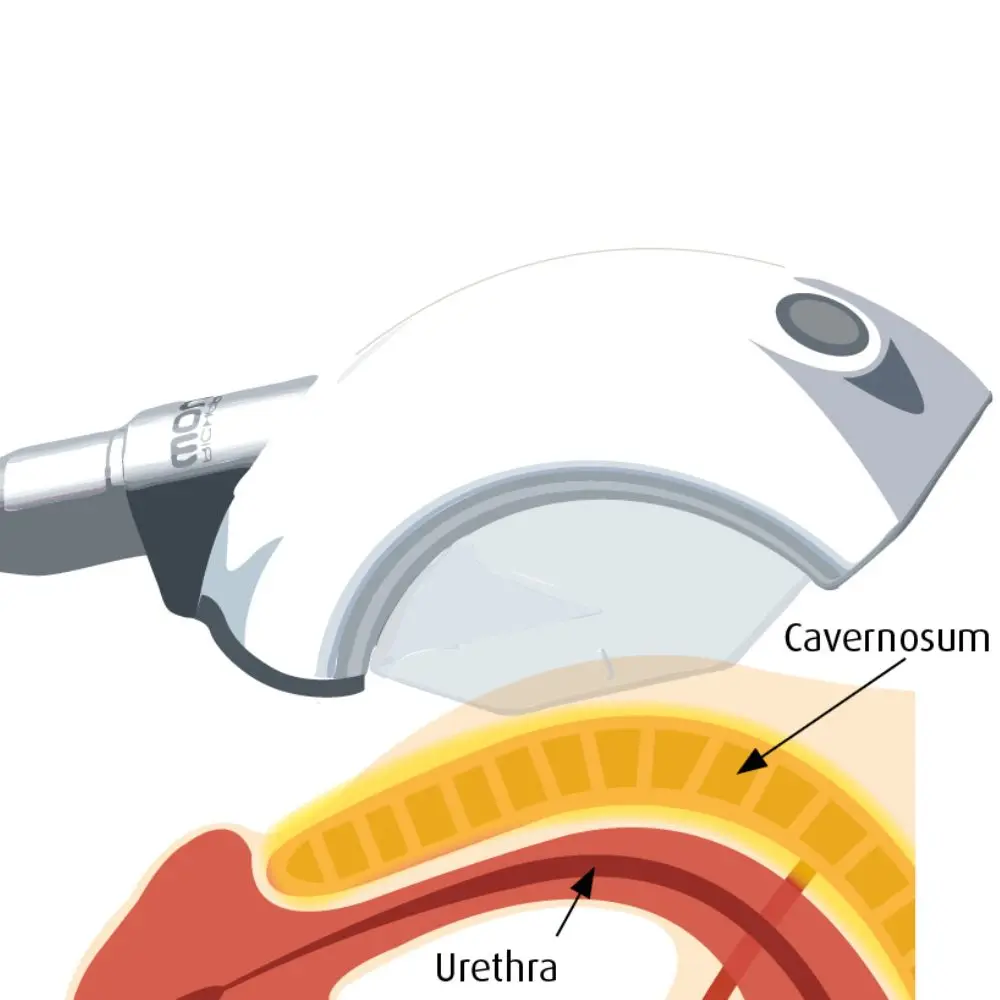 image_6.webp